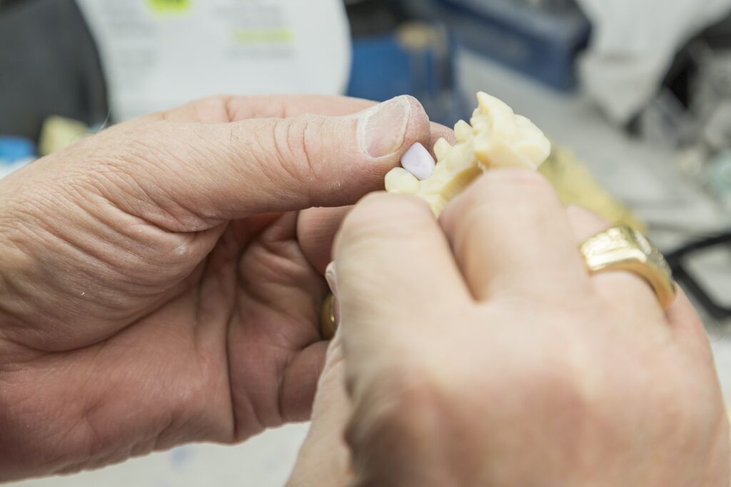 Dentist examining a patient's dental crown at Hillcrest Family Dentistry in Medford OR