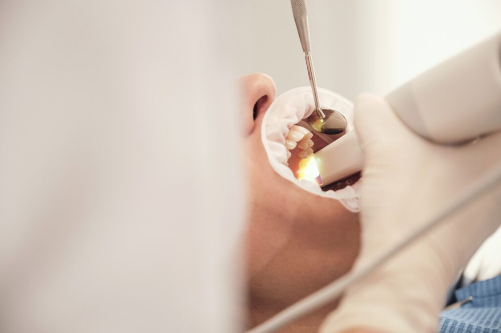 Dentist examining a cracked tooth in a patient at Hillcrest Family Dentistry in Medford OR